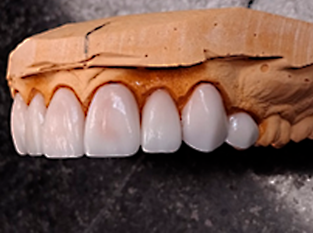 dental-design